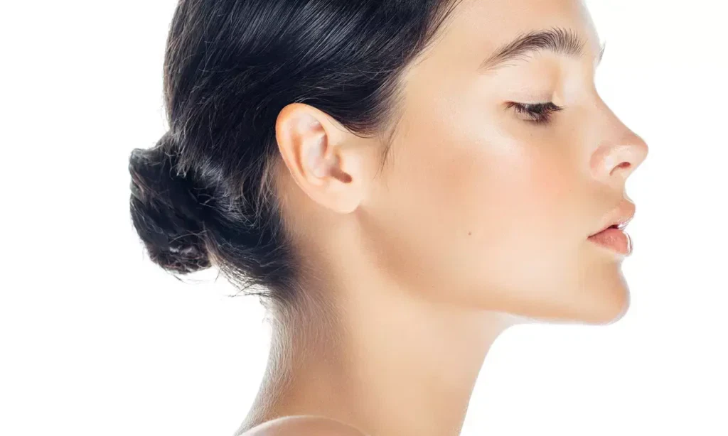 Kybella